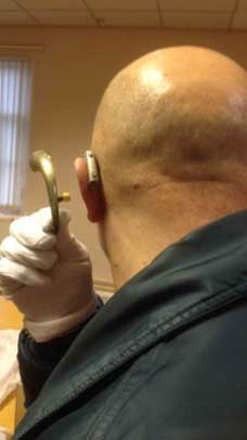 A man with a hearing aid